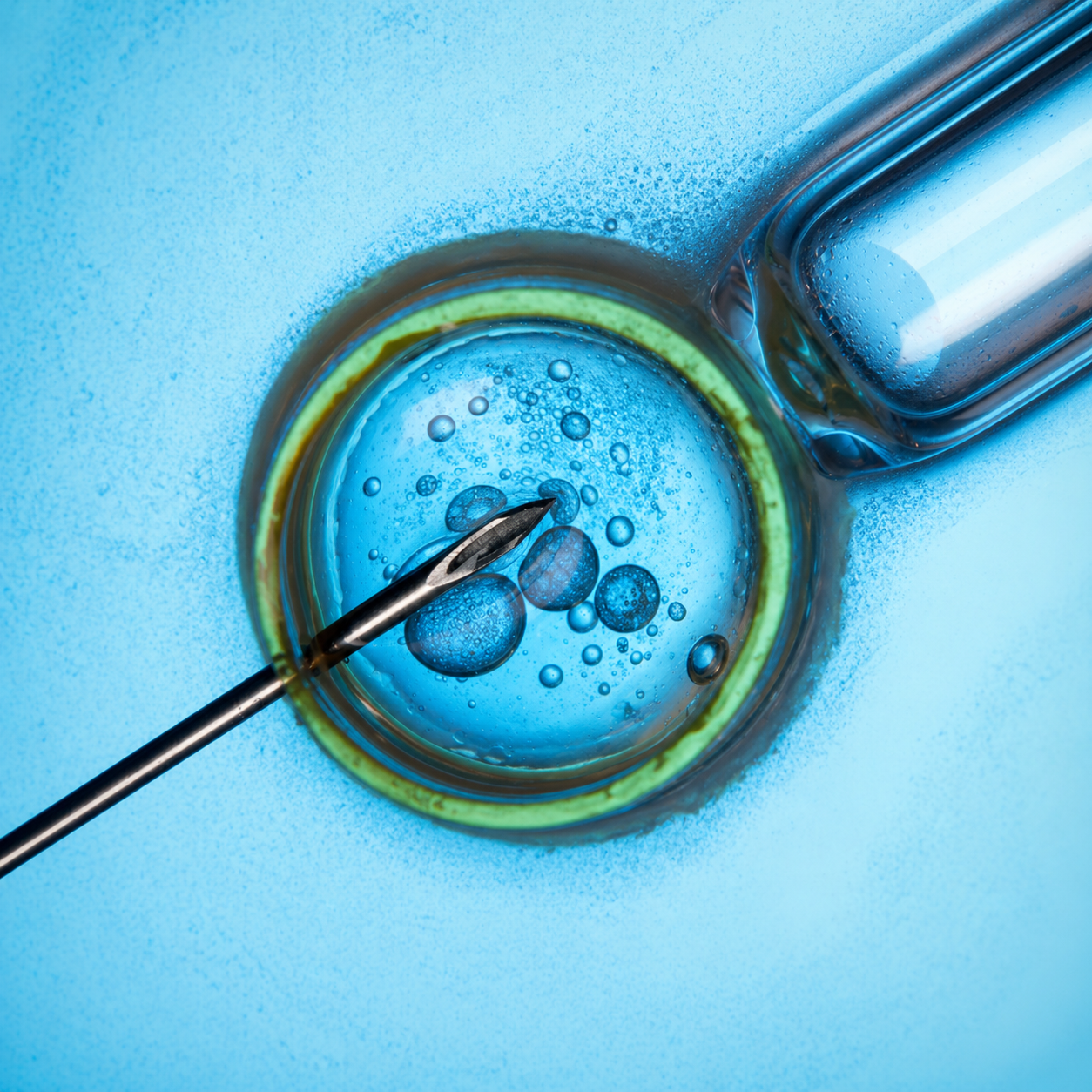 Fertility Treatment